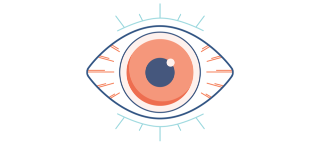 Illustration eines trockenen, roten Auges
