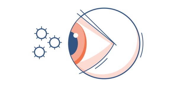Illustration eines Auges mit Pollen in der Luft